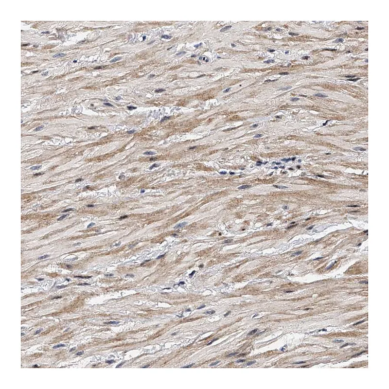 Atlas Antibodies Anti-ZNF462 Antibody
