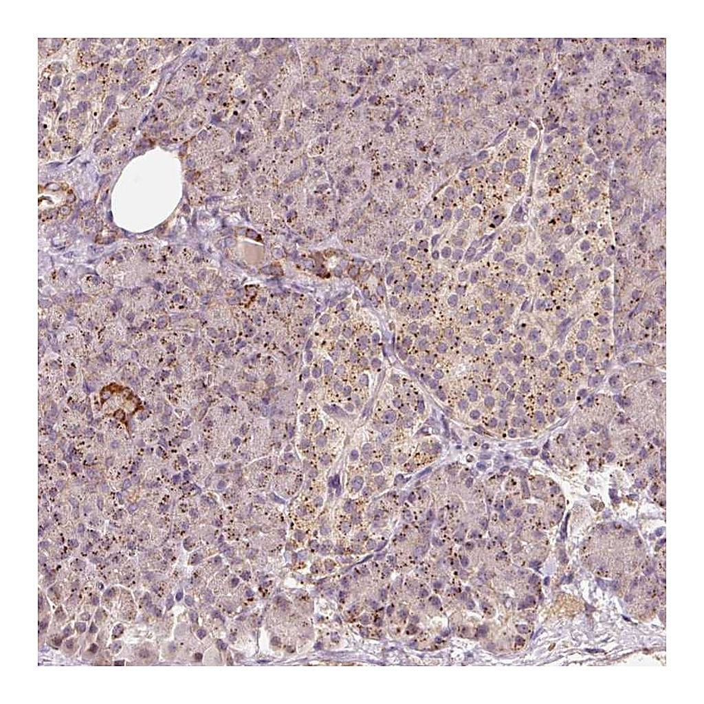 Atlas Antibodies Anti-ZNF460 Antibody