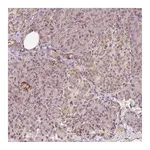 Atlas Antibodies Anti-ZNF460 Antibody