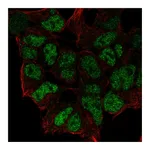 Atlas Antibodies Anti-ZNF460 Antibody