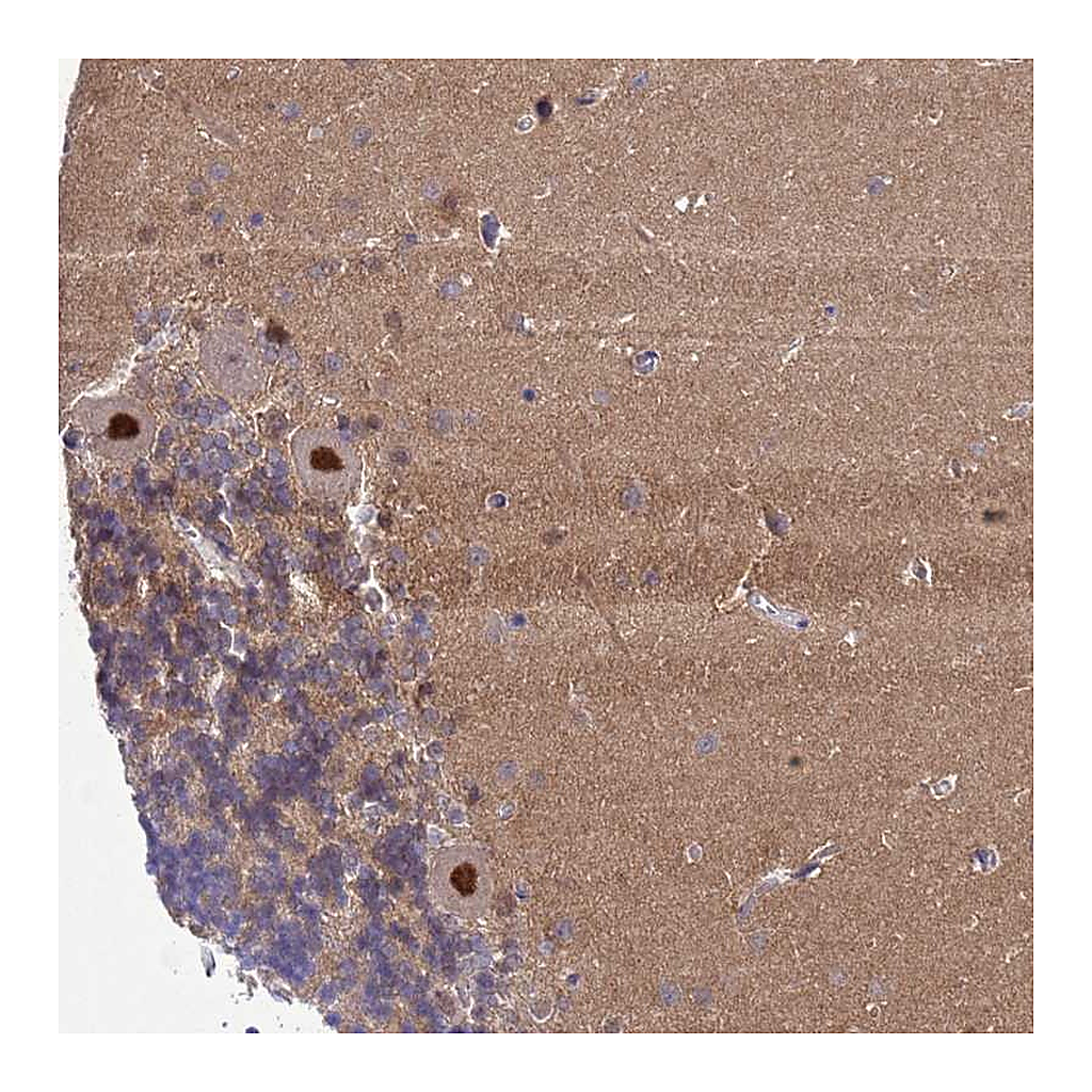 Atlas Antibodies Anti-ZNF461 Antibody