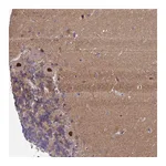Atlas Antibodies Anti-ZNF461 Antibody