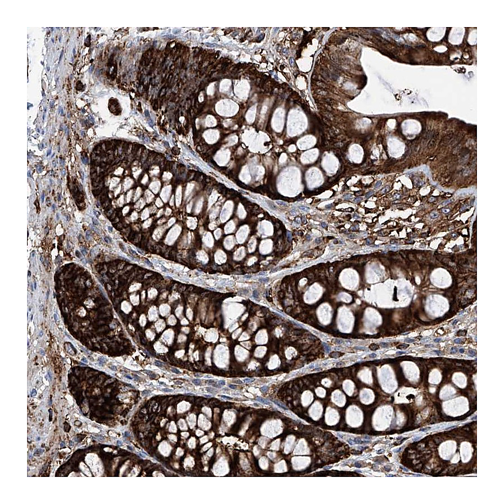 Atlas Antibodies Anti-ZNF484 Antibody