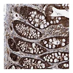 Atlas Antibodies Anti-ZNF484 Antibody