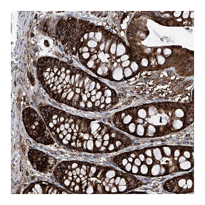 Atlas Antibodies Anti-ZNF484 Antibody