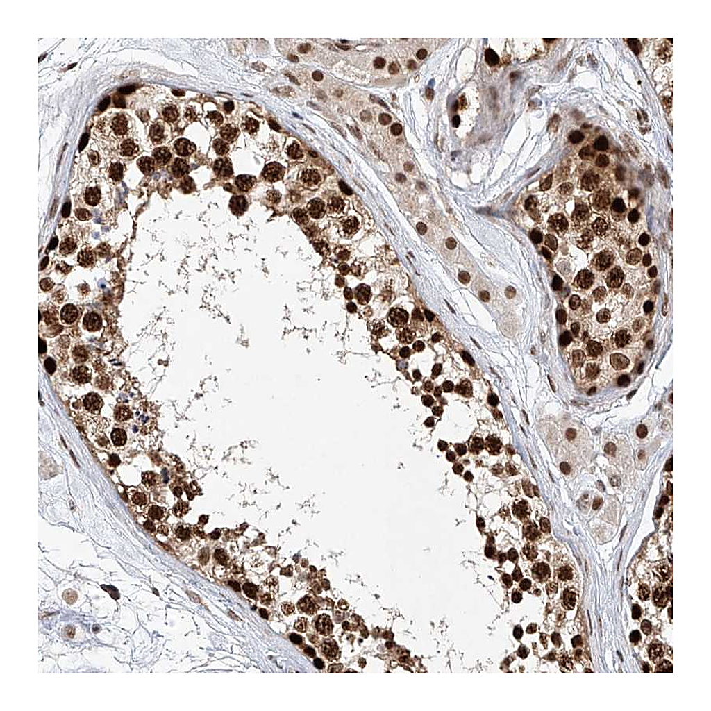 Atlas Antibodies Anti-ZNF470 Antibody