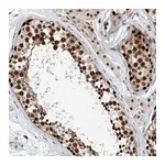 Atlas Antibodies Anti-ZNF470 Antibody