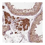 Atlas Antibodies Anti-ZNF471 Antibody