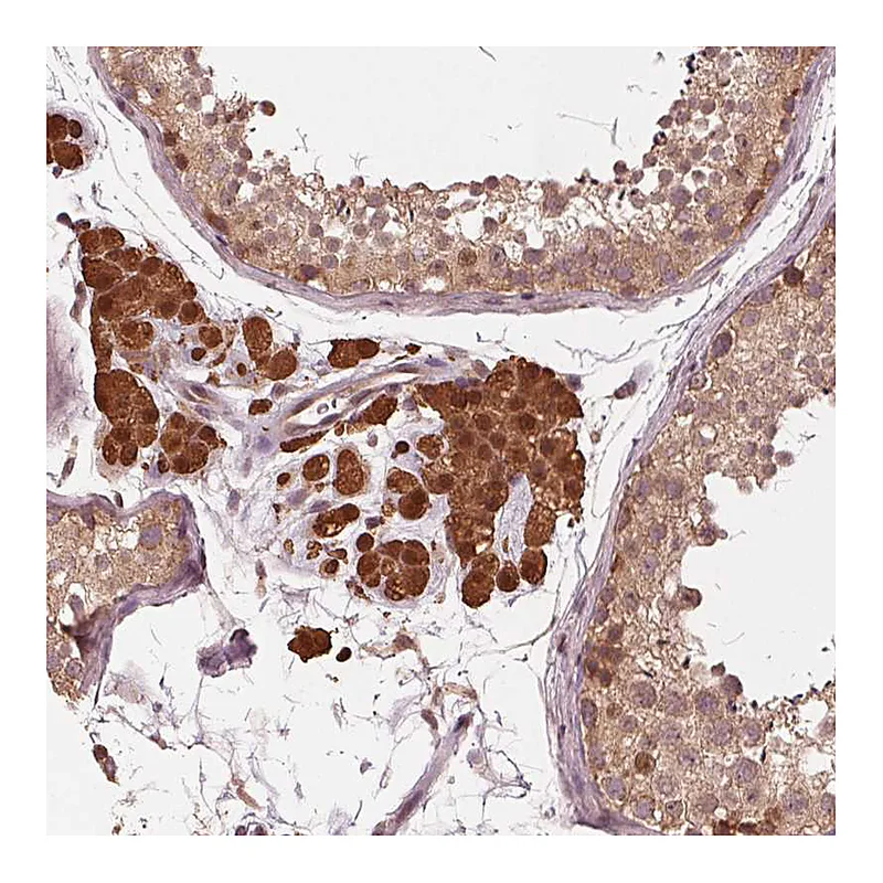 Atlas Antibodies Anti-ZNF471 Antibody