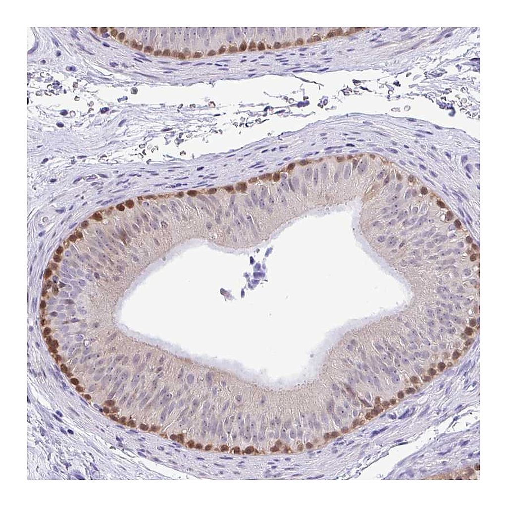 Atlas Antibodies Anti-ZNF485 Antibody