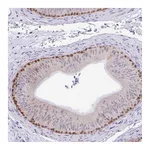 Atlas Antibodies Anti-ZNF485 Antibody