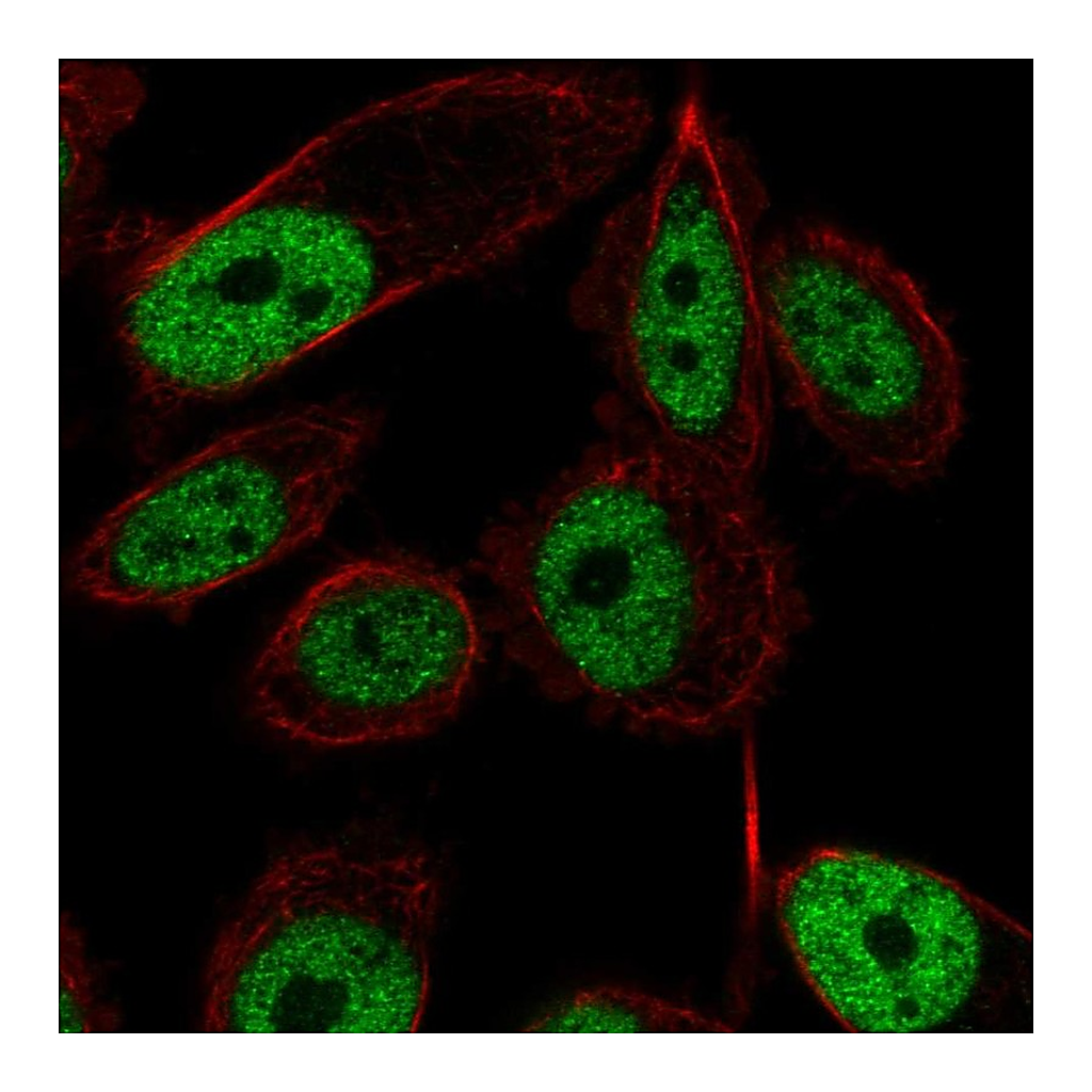 Atlas Antibodies Anti-ZNF473 Antibody