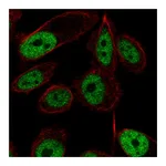 Atlas Antibodies Anti-ZNF473 Antibody
