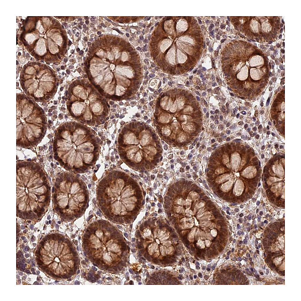 Atlas Antibodies Anti-ZNF480 Antibody