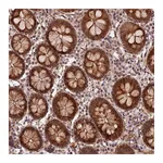 Atlas Antibodies Anti-ZNF480 Antibody