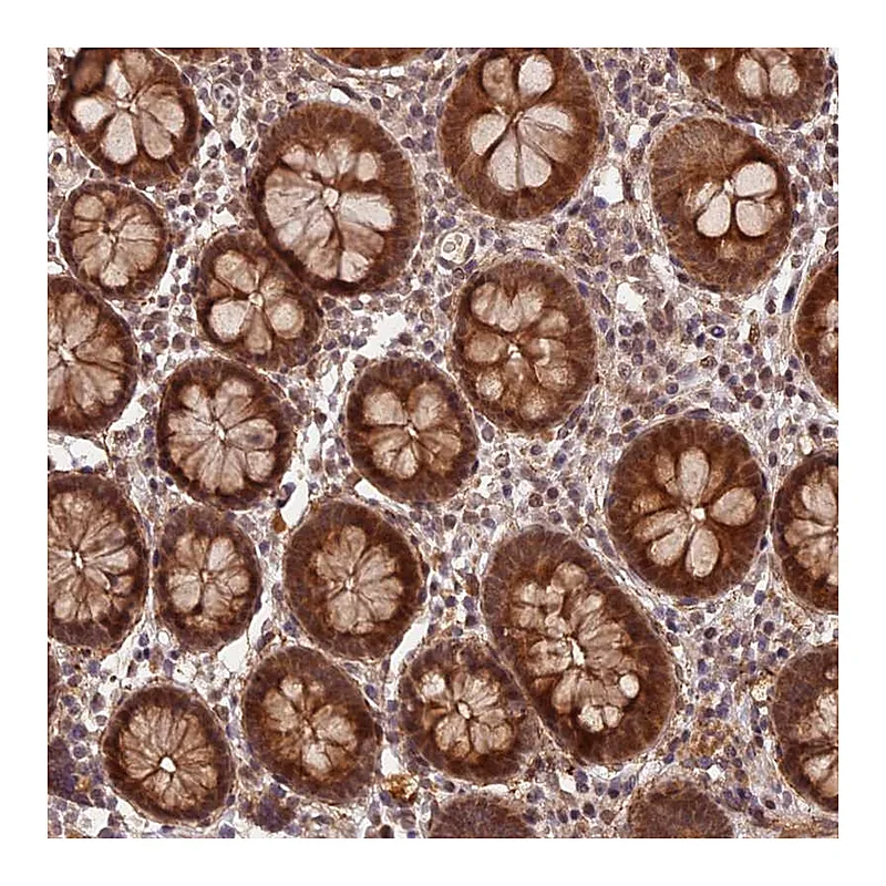 Atlas Antibodies Anti-ZNF480 Antibody