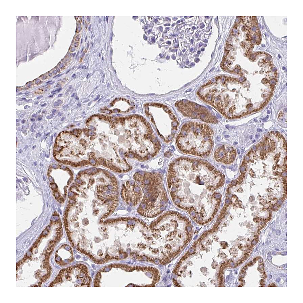 Atlas Antibodies Anti-ZNF483 Antibody