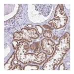 Atlas Antibodies Anti-ZNF483 Antibody