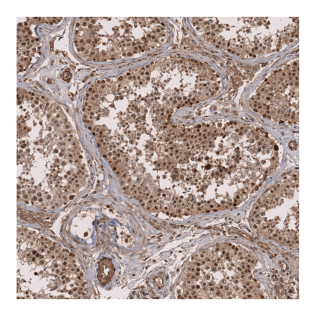 Atlas Antibodies Anti-ZNF473 Antibody