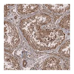 Atlas Antibodies Anti-ZNF473 Antibody