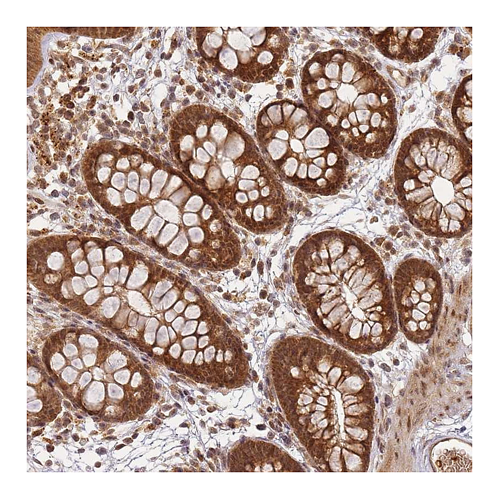 Atlas Antibodies Anti-ZNF497 Antibody
