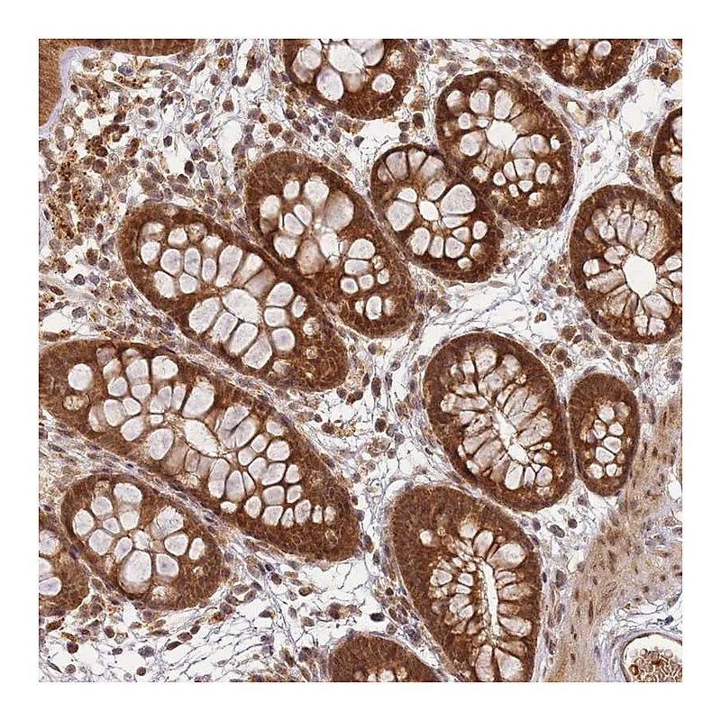Atlas Antibodies Anti-ZNF497 Antibody