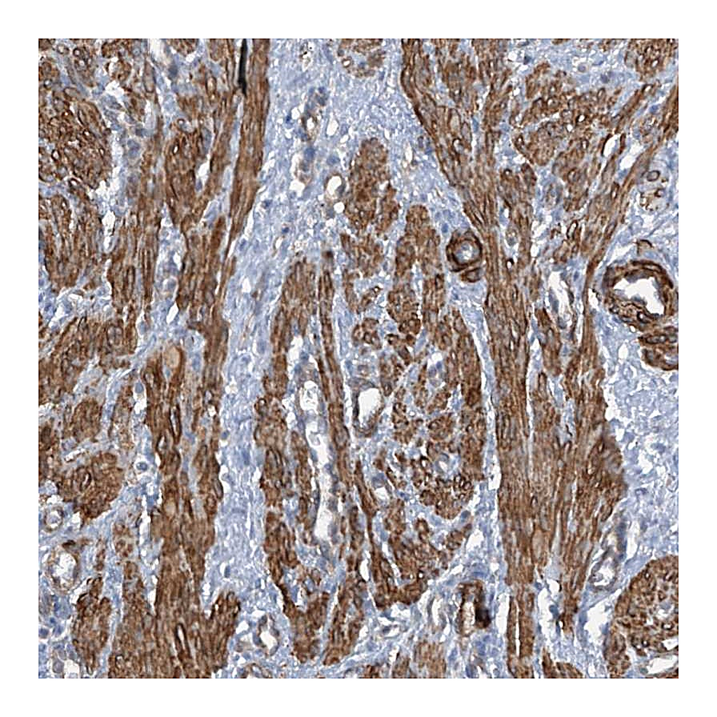 Atlas Antibodies Anti-ZNF490 Antibody