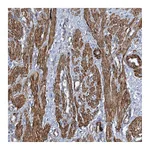 Atlas Antibodies Anti-ZNF490 Antibody