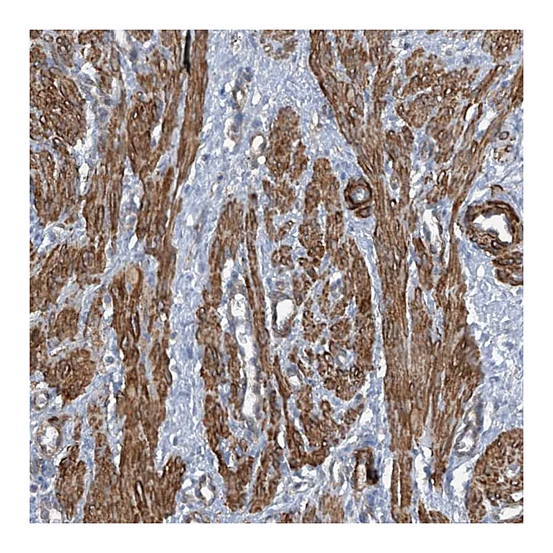 Atlas Antibodies Anti-ZNF490 Antibody