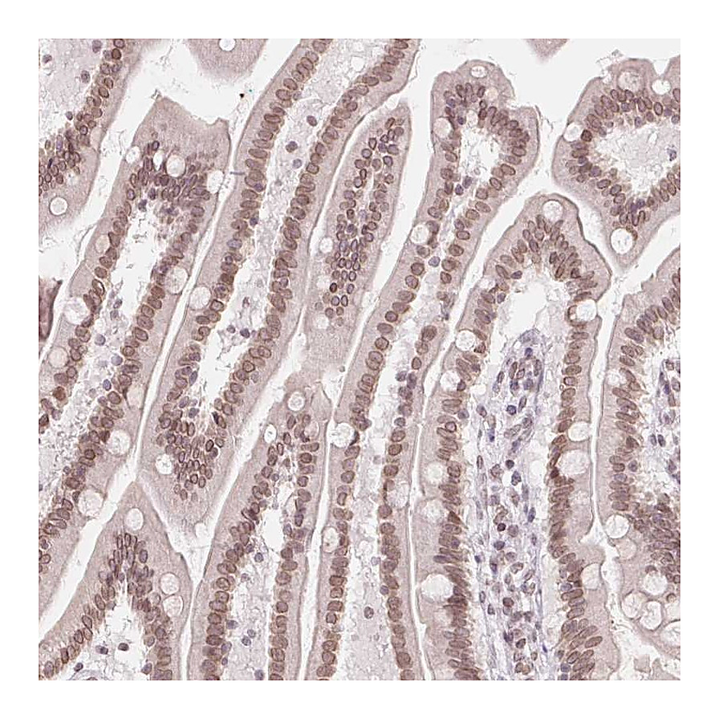 Atlas Antibodies Anti-ZNF488 Antibody