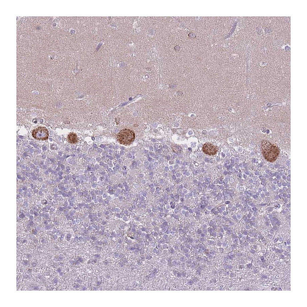 Atlas Antibodies Anti-ZNF501 Antibody