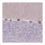 Atlas Antibodies Anti-ZNF501 Antibody