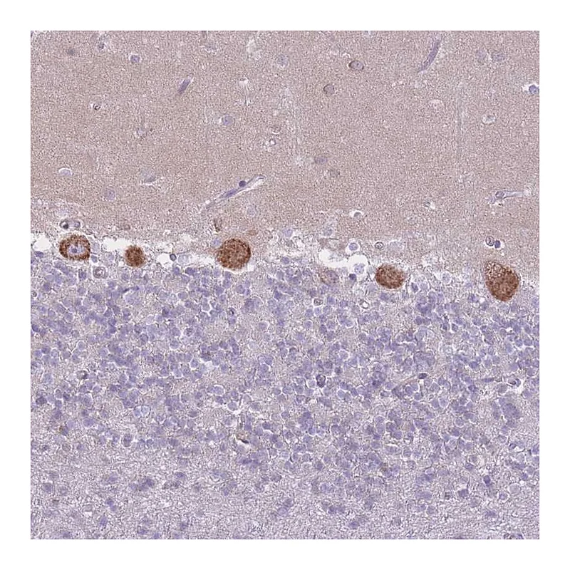 Atlas Antibodies Anti-ZNF501 Antibody