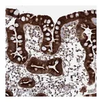 Atlas Antibodies Anti-ZNF488 Antibody