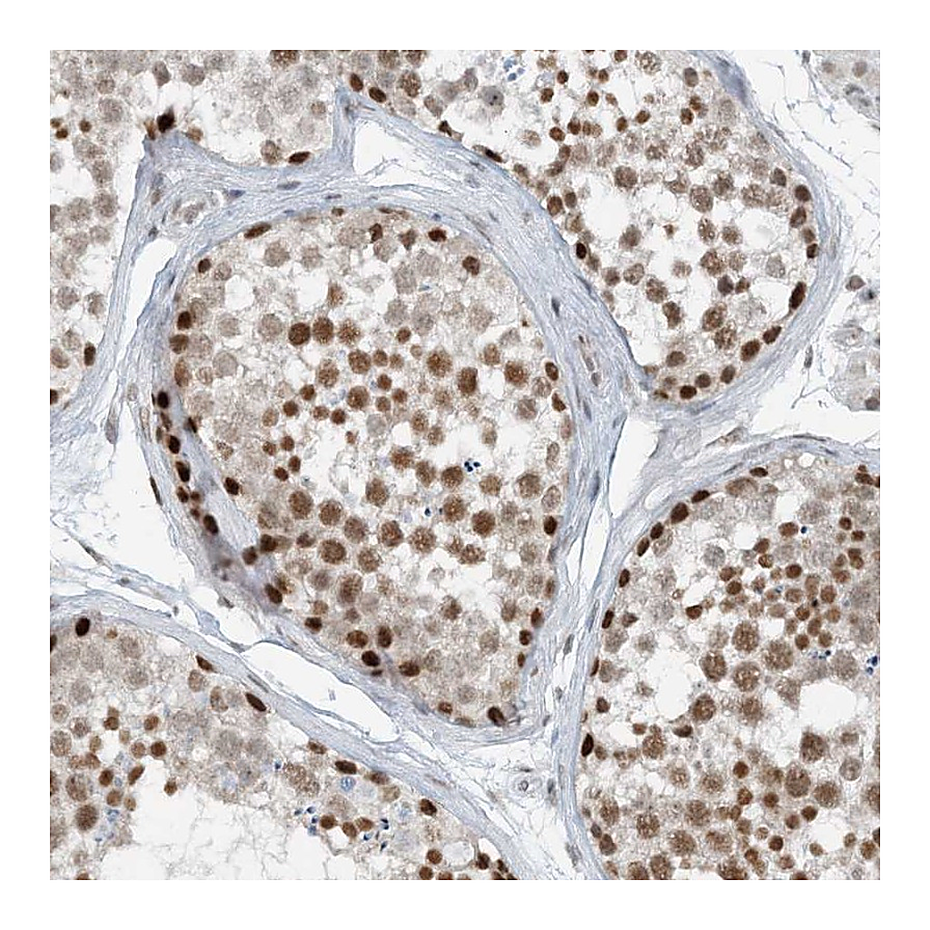 Atlas Antibodies Anti-ZNF500 Antibody