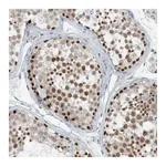 Atlas Antibodies Anti-ZNF500 Antibody