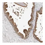 Atlas Antibodies Anti-ZNF502 Antibody