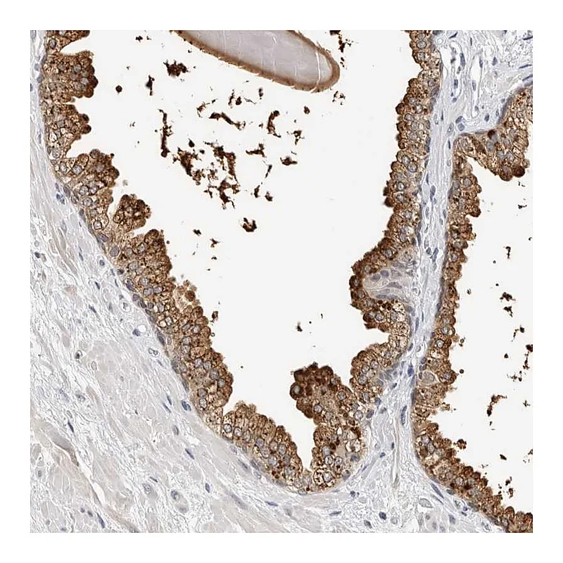 Atlas Antibodies Anti-ZNF502 Antibody