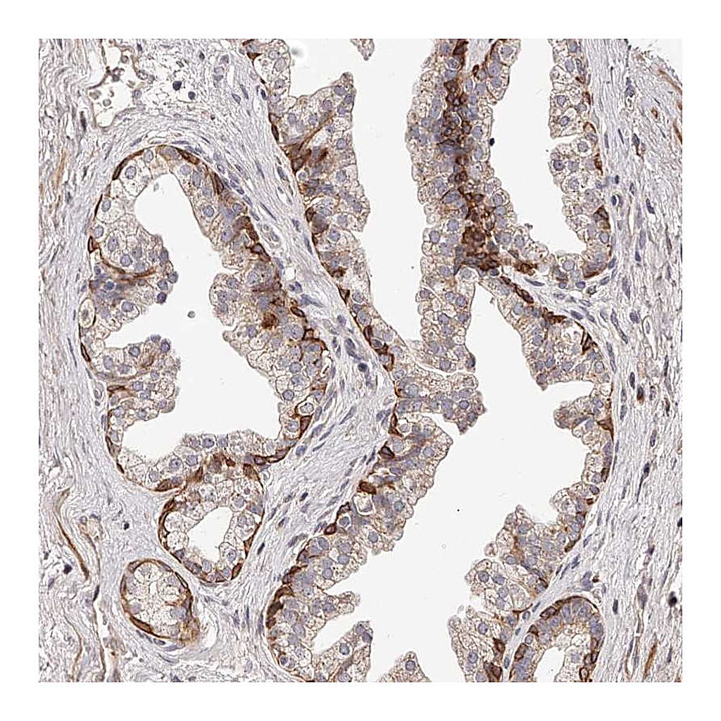 Atlas Antibodies Anti-ZNF502 Antibody