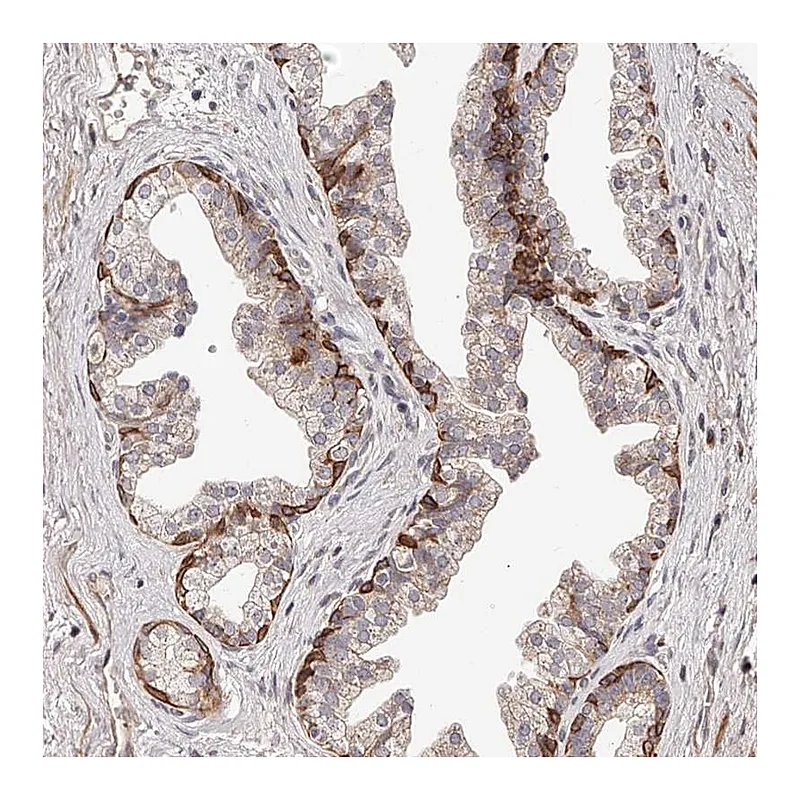 Atlas Antibodies Anti-ZNF502 Antibody