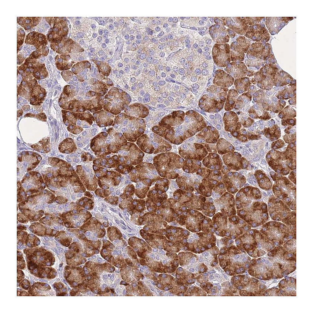 Atlas Antibodies Anti-ZNF510 Antibody