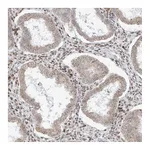 Atlas Antibodies Anti-ZNF512 Antibody