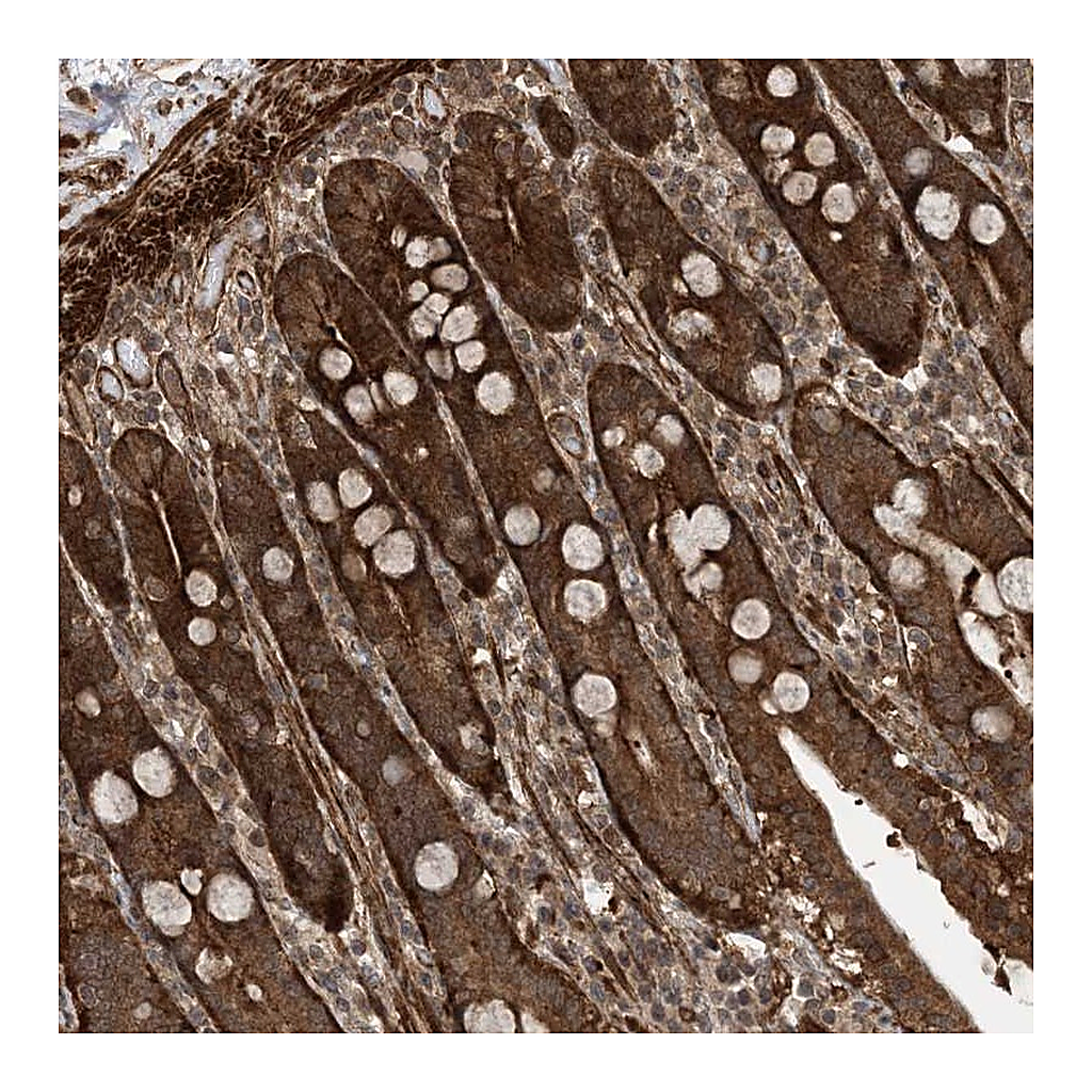 Atlas Antibodies Anti-ZNF511 Antibody