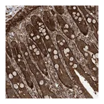 Atlas Antibodies Anti-ZNF511 Antibody