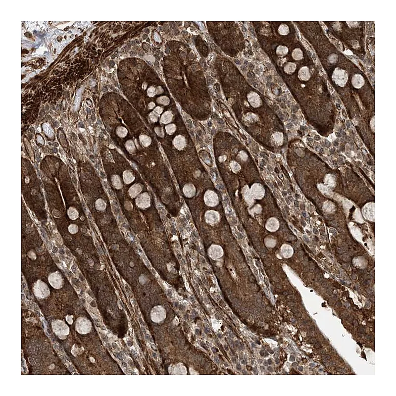 Atlas Antibodies Anti-ZNF511 Antibody