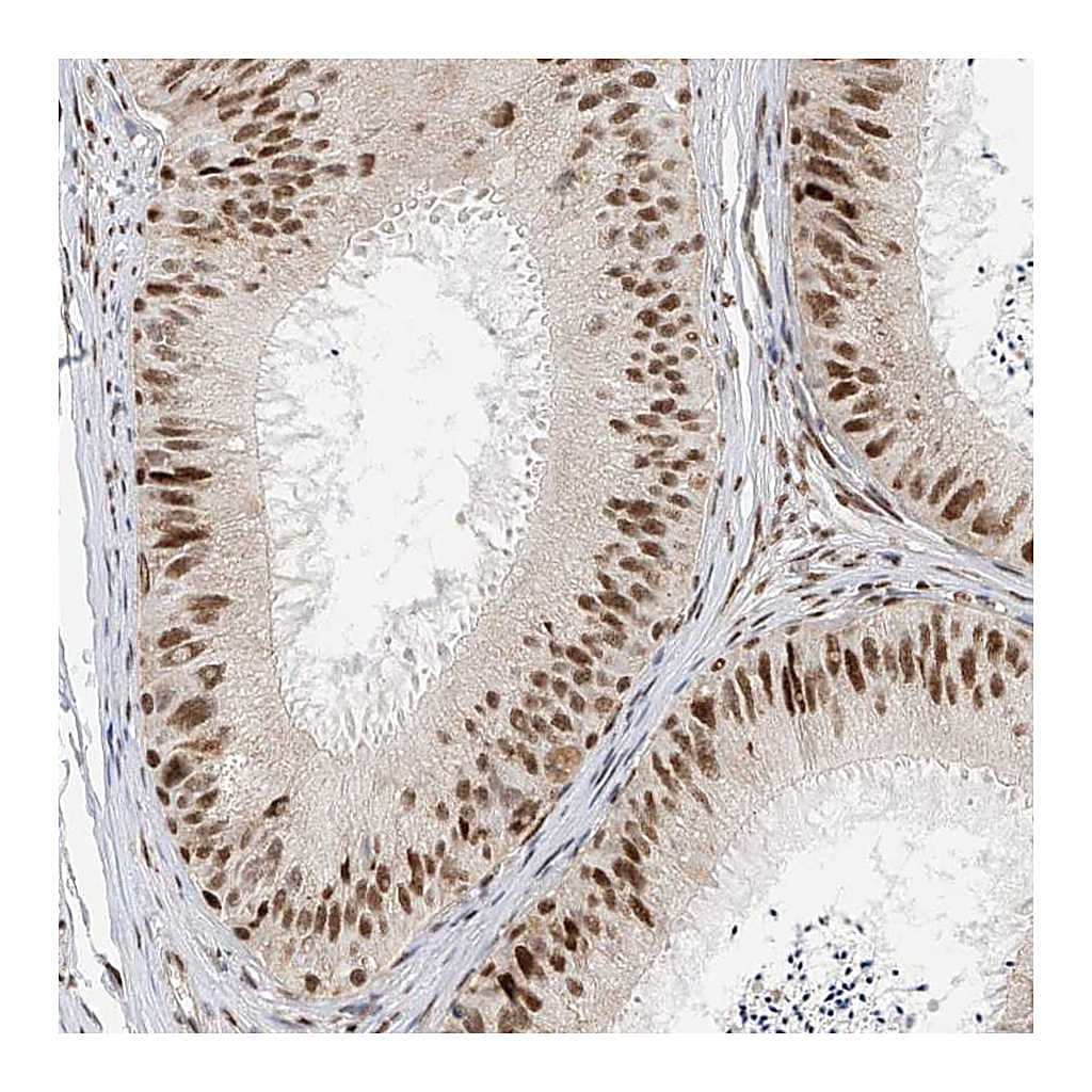 Atlas Antibodies Anti-ZNF514 Antibody