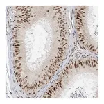 Atlas Antibodies Anti-ZNF514 Antibody