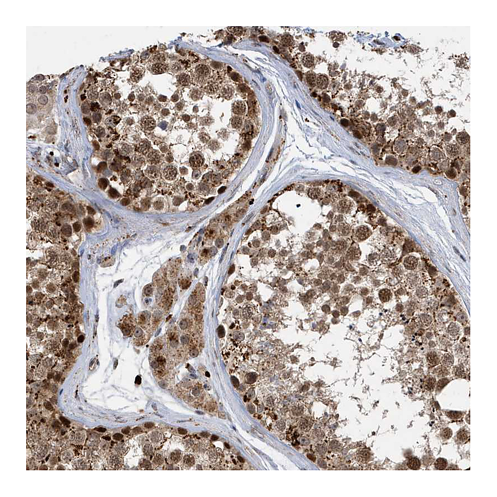 Atlas Antibodies Anti-ZNF507 Antibody