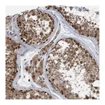 Atlas Antibodies Anti-ZNF507 Antibody