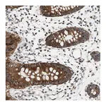 Atlas Antibodies Anti-ZNF512B Antibody